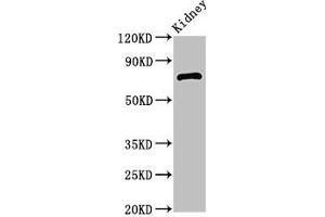 Western Blot Positive WB detected in: Mouse kidney tissue All lanes: ZBTB16 antibody at 2. (ZBTB16 anticorps  (AA 126-420))