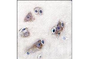 Image no. 2 for anti-Cytochrome P450, Family 26, Subfamily C, Polypeptide 1 (CYP26C1) (C-Term) antibody (ABIN360260)