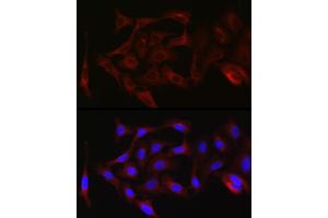 Immunofluorescence analysis of A-549 cells using PKC zeta Rabbit pAb (ABIN6128468, ABIN6146211, ABIN6146213 and ABIN6221376) at dilution of 1:100 (40x lens).