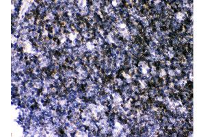Anti- ATP2A3 antibody,IHC(P) IHC(P): Rat Thymus Tissue