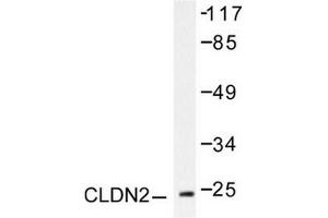 Image no. 2 for anti-Claudin 2 (CLDN2) antibody (ABIN265361) (Claudin 2 anticorps)