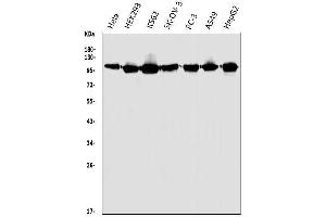 Western blot analysis of HGS using anti-HGS antibody (ABIN7601205).