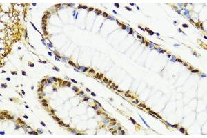 Immunohistochemistry of paraffin-embedded Human colon using CTCF Polyclonal Antibody at dilution of 1:100 (40x lens). (CTCF anticorps)
