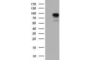 Western Blotting (WB) image for anti-phosphoinositide-3-Kinase Adaptor Protein 1 (PIK3AP1) antibody (ABIN1496824)