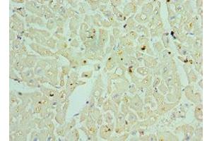 Immunohistochemistry of paraffin-embedded human heart tissue using ABIN7153379 at dilution of 1:100 (TDG anticorps  (AA 141-410))