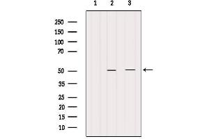 Western blot analysis of extracts from various samples, using CRLS1-Specific Antibody. (CRLS1 anticorps  (Internal Region))
