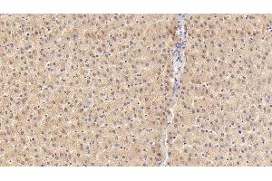 Detection of SLC in Porcine Liver Tissue using Polyclonal Antibody to Secondary Lymphoid Tissue Chemokine (SLC)