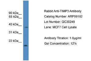 WB Suggested Anti-TIMP3  Antibody Titration: 0.
