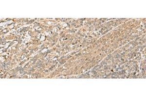 Immunohistochemistry of paraffin-embedded Human tonsil tissue using IPO11 Polyclonal Antibody at dilution of 1:70(x200)