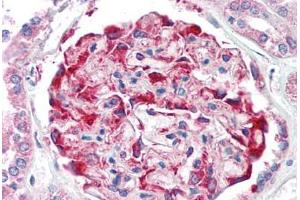 Human Kidney (formalin-fixed, paraffin-embedded) stained with CDH11 antibody ABIN337036 at 5 ug/ml followed by biotinylated goat anti-rabbit IgG secondary antibody ABIN481713, alkaline phosphatase-streptavidin and chromogen.