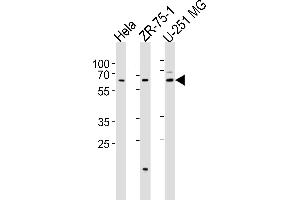 Western blot analysis of lysates from Hela, ZR-75-1, U-251 MG cell line (from left to right), using STS2 Antibody (C-term) (ABIN6244259 and ABIN6577456). (SPATS2 anticorps  (C-Term))