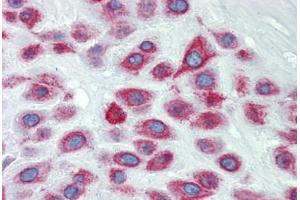 Placenta, Human: Formalin-Fixed, Paraffin-Embedded (FFPE)