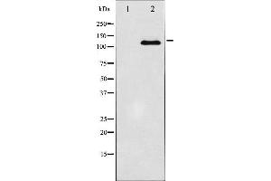 Western blot analysis of JAK2 expression in HT29 whole cell lysates,The lane on the left is treated with the antigen-specific peptide. (JAK2 anticorps  (C-Term))