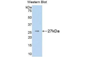 Western Blotting (WB) image for anti-Melanoma Associated Chondroitin Sulfate Proteoglycan (MCSP) (AA 1705-1942) antibody (ABIN1859793)