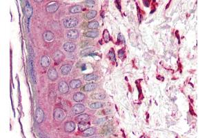 Immunohistochemistry staining of human skin (paraffin sections) using anti-vimentin (VI-10).