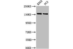 Western Blot Positive WB detected in: K562 whole cell lysate, PC-3 whole cell lysate All lanes: NRDC antibody at 3. (NRD1 anticorps  (AA 32-113))