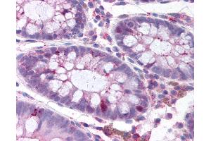 Anti-PLK1 antibody IHC of human colon. (PLK1 anticorps  (pThr210))