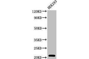 Western Blot Positive WB detected in: HEK293 whole cell lysate All lanes: TSR2 antibody at 2 μg/mL Secondary Goat polyclonal to rabbit IgG at 1/50000 dilution Predicted band size: 21 kDa Observed band size: 21 kDa (TSR2 anticorps  (AA 1-191))