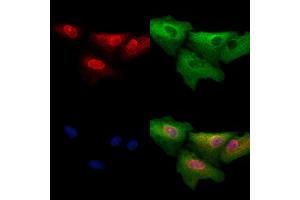 ABIN6257358 and ABIN6273564 staining  cells by IF/ICC. (Myocardin anticorps  (Internal Region))