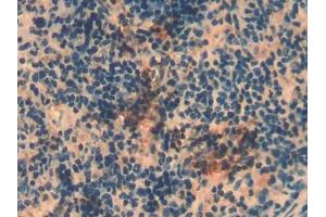 DAB staining on IHC-P; Samples: Mouse Spleen Tissue (MMP8 anticorps  (AA 212-451))