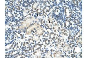 ZMYND11 antibody was used for immunohistochemistry at a concentration of 4-8 ug/ml to stain Epithelial cells of renal tubule (arrows) in Human Kidney.