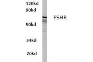 Image no. 1 for anti-Follicle Stimulating Hormone Receptor (FSHR) antibody (ABIN317650) (FSHR anticorps)