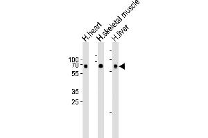 Western blot analysis of lysates from human heart, skeletal muscle and liver tissue lysate (from left to right), using Cry2 Antibody(R579) at 1:1000 at each lane.