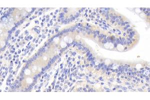 Detection of CALR in Human Small intestine Tissue using Polyclonal Antibody to Calreticulin (CALR)