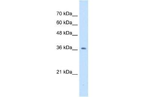 NUDT9 antibody used at 1 ug/ml to detect target protein. (NUDT9 anticorps)