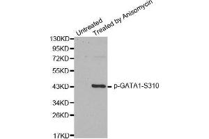 Western blot analysis of extracts from HT29 cells, using Phospho-GATA1-S310 antibody. (GATA1 anticorps  (pSer310))