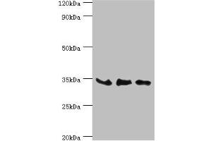 Western blot All lanes: SRM antibody at 8 μg/mL Lane 1: PC-3 whole cell lysate Lane 2: Hela whole cell lysate Lane 3: HepG2 whole cell lysate Secondary Goat polyclonal to rabbit IgG at 1/10000 dilution Predicted band size: 34 kDa Observed band size: 34 kDa (Spermidine Synthase anticorps  (AA 1-302))