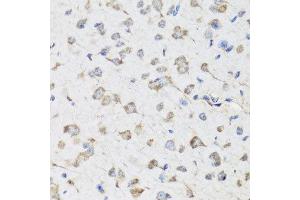 Immunohistochemistry of paraffin-embedded mouse brain using USP25 antibody at dilution of 1:100 (x40 lens). (USP25 anticorps)