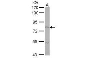 Image no. 1 for anti-rho-Related BTB Domain Containing 1 (RHOBTB1) (AA 320-623) antibody (ABIN1500699)