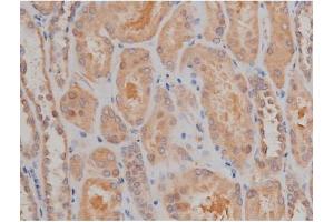 ABIN6267334 at 1/200 staining Human kidney tissue sections by IHC-P. (SP1 anticorps  (pThr739))