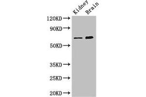 Western Blot Positive WB detected in: Mouse kidney tissue, Mouse brain tissue All lanes: ME3 antibody at 3 μg/mL Secondary Goat polyclonal to rabbit IgG at 1/50000 dilution Predicted band size: 68, 39 kDa Observed band size: 68 kDa (ME3 anticorps  (AA 547-598))