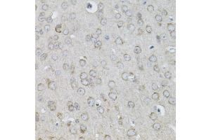 Immunohistochemistry of paraffin-embedded mouse brain using IL13 antibody (ABIN3022881, ABIN3022882, ABIN3022883 and ABIN6219278) (40x lens).