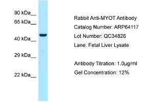Western Blotting (WB) image for anti-Myotilin (MYOT) (C-Term) antibody (ABIN2789737) (Myotilin anticorps  (C-Term))