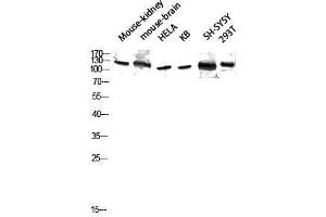 Western Blot (WB) analysis of Mouse Kidney Mouse Brain HeLa KB SH-SY5Y 293T lysis using GCP5 antibody. (TUBGCP5 anticorps  (Internal Region))