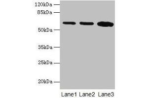 Western blot All lanes: SPTLC2 antibody at 12 μg/mL Lane 1: HepG2 whole cell lysate Lane 2: A549 whole cell lysate Lane 3: HT29 whole cell lysate Secondary Goat polyclonal to rabbit IgG at 1/10000 dilution Predicted band size: 63 kDa Observed band size: 63 kDa (SPTLC2 anticorps  (AA 88-562))