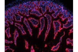 Immunofluorescence (IF) image for anti-Cadherin 1, Type 1, E-Cadherin (Epithelial) (CDH1) antibody (Alexa Fluor 594) (ABIN2656827)