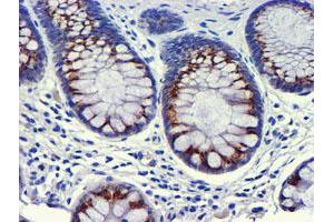 Immunohistochemical staining of paraffin-embedded Human colon tissue using anti-GOLM1 mouse monoclonal antibody. (GOLM1 anticorps)