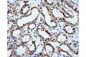 Immunohistochemical staining of paraffin-embedded Kidney tissue using anti-PSMC3mouse monoclonal antibody. (PSMC3 anticorps)