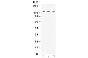 Western blot testing of 1) rat thymus, 2) mouse thymus and 3) MCF7 lysate with CIITA antibody at 0. (CIITA anticorps)