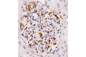 Antibody staining RHBDF2 in human kidney tissue sections by Immunohistochemistry (IHC-P - paraformaldehyde-fixed, paraffin-embedded sections). (RHBDF2 anticorps  (N-Term))