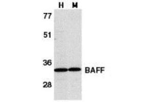 Western blot analysis of BAFF in human HL60 cell lysate (H) and mouse spleen tissue lysate (M) with AP30115PU-N BAFF antibody at 1 μg/ml.