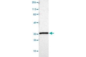 Western blot analysis of Lane 1: Human cell line RT-4 with HCCS polyclonal antibody  at 1:100-1:25 dilution. (HCCS anticorps)
