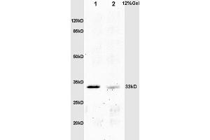 L1 mouse embryo lysates L2 mouse intestine lysates probed with Anti phospho-Crkl(Tyr251) Polyclonal Antibody, Unconjugated (ABIN703420) at 1:200 overnight at 4 °C. (CrkL anticorps  (pTyr251))