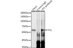 Immunoprecipitation analysis of 300 μg extracts of HeLa cells using 3 μg YY1 antibody (ABIN7271428).