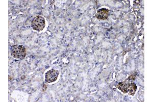 IHC analysis of Laminin using anti-Laminin antibody .