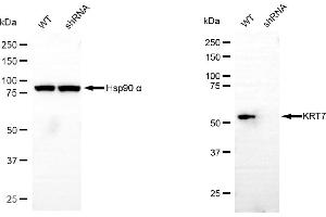 Western blotting analysis using keratin 7 antibody (ABIN7799187). (Recombinant Cytokeratin 7 anticorps)